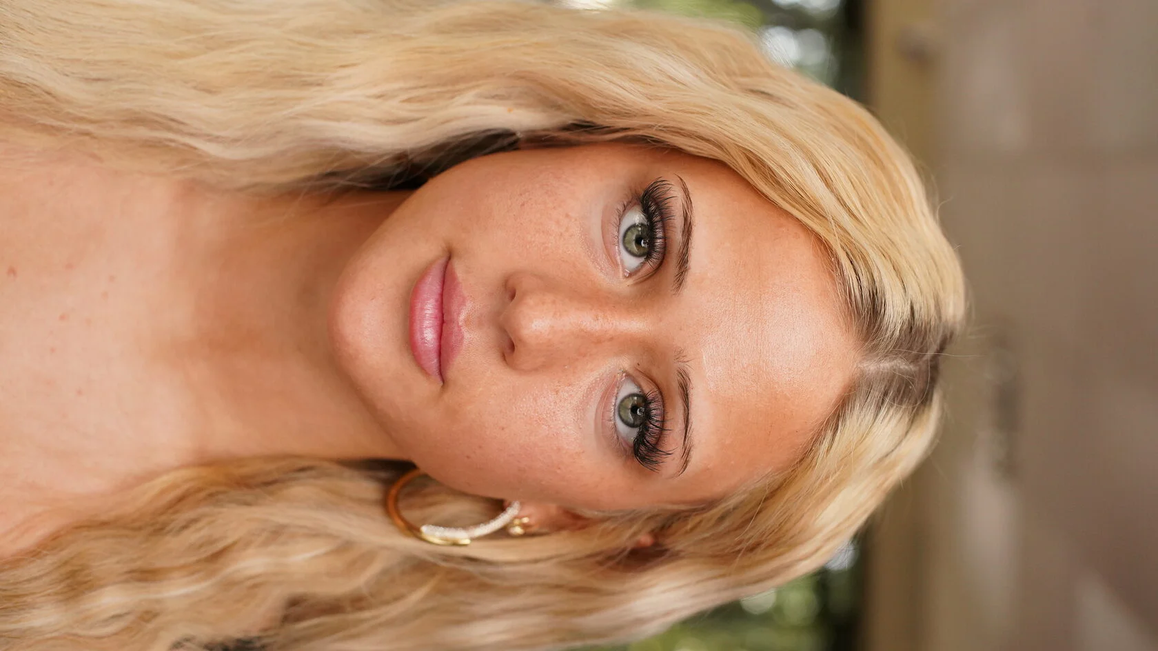 Oily skin · 6 weeks healed