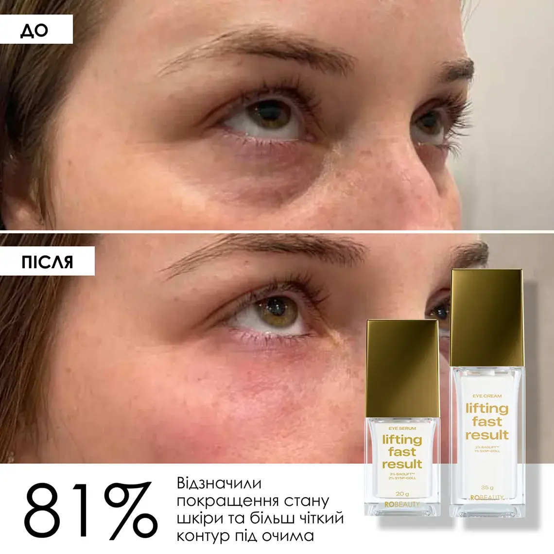 Lifting Fast Result Eye Serum і Cream
