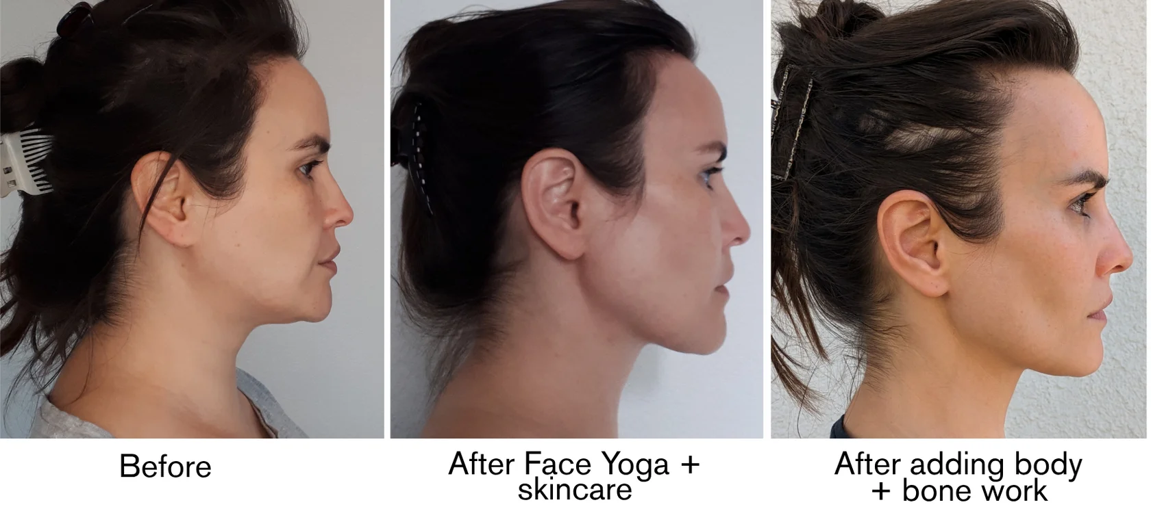 Lilya’s three-stage facial transformation shown side by side