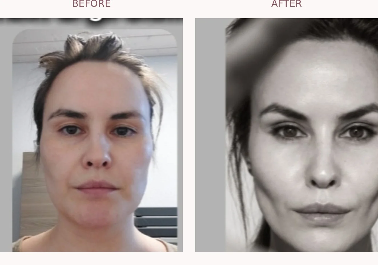 My before-and-after photos