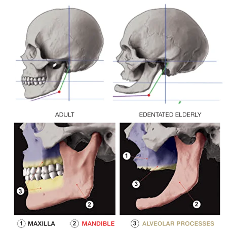 Mandible illustration