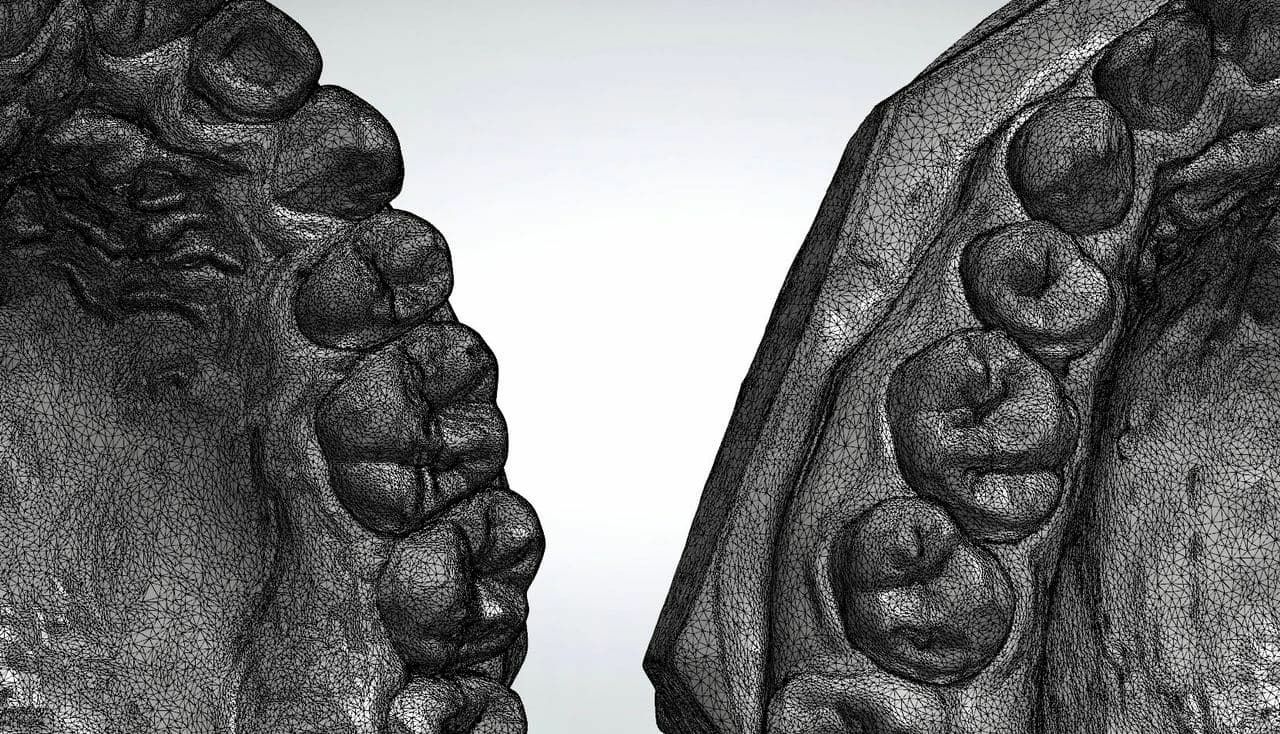 Medit 3D scanner