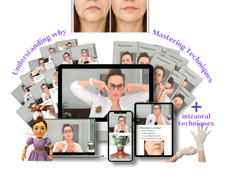Marionette Lines Course