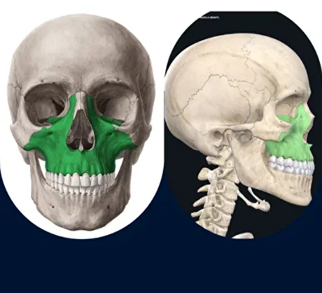 Anatomical illustration highlighting the maxilla