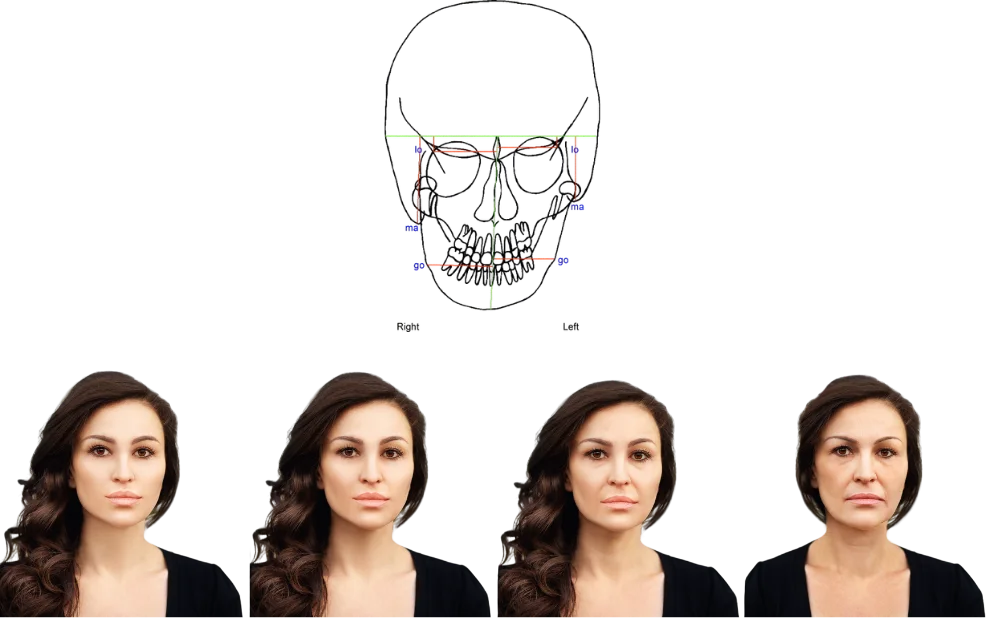 Facial structure and age-related changes, combined illustration