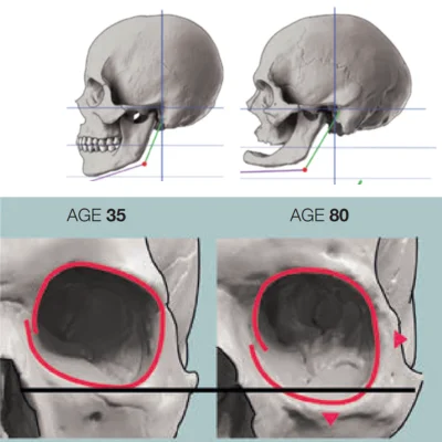 Facial skeletal illustration