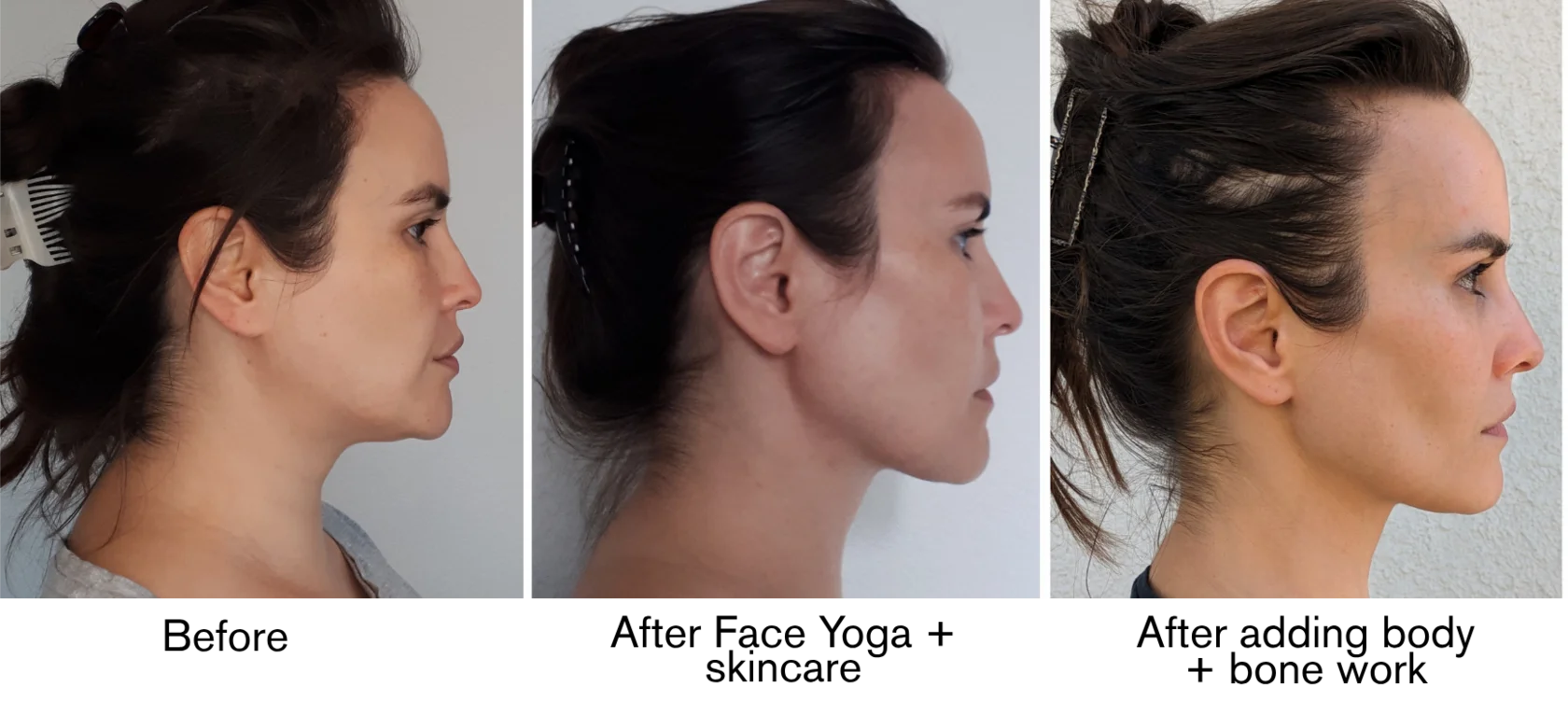 Lilya VisageFit facial transformation