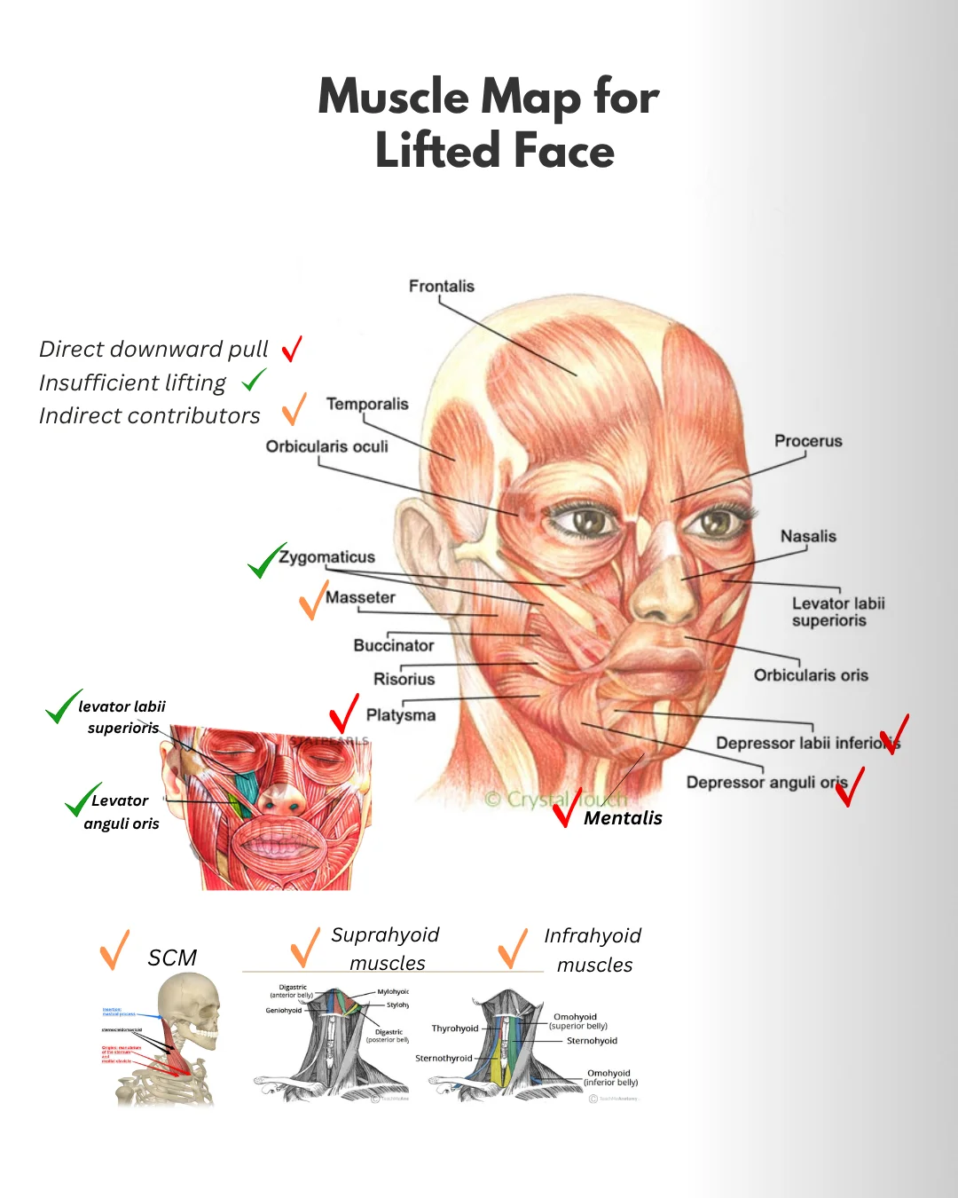 Facial and neck muscle map
