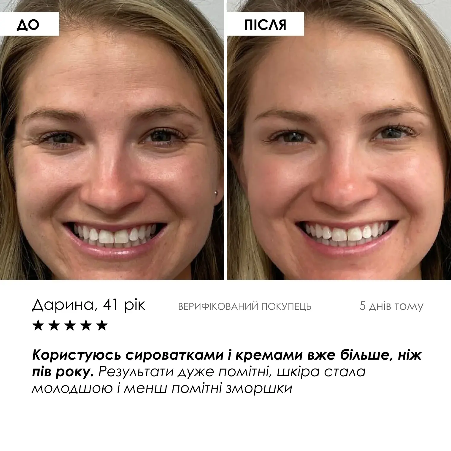 Набір нічного догляду з ретинолом ROBEAUTY