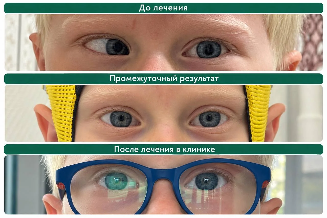 Lumos Vision — ბავშვთა სიელმის მკურნალობა