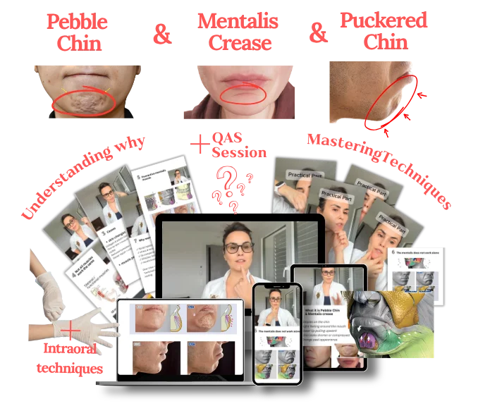 Pebble Chin and Mentalis Crease course