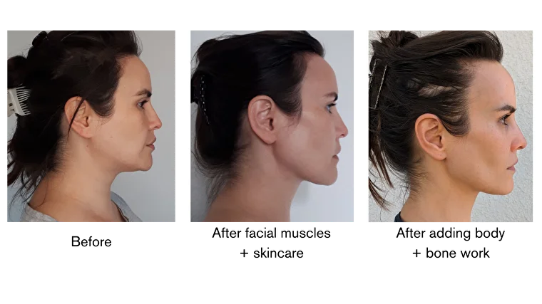 VisageFit founder’s before-and-after facial rejuvenation progression
